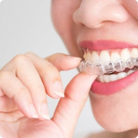 Niềng răng bằng mắc cài sứ – Mức độ 1